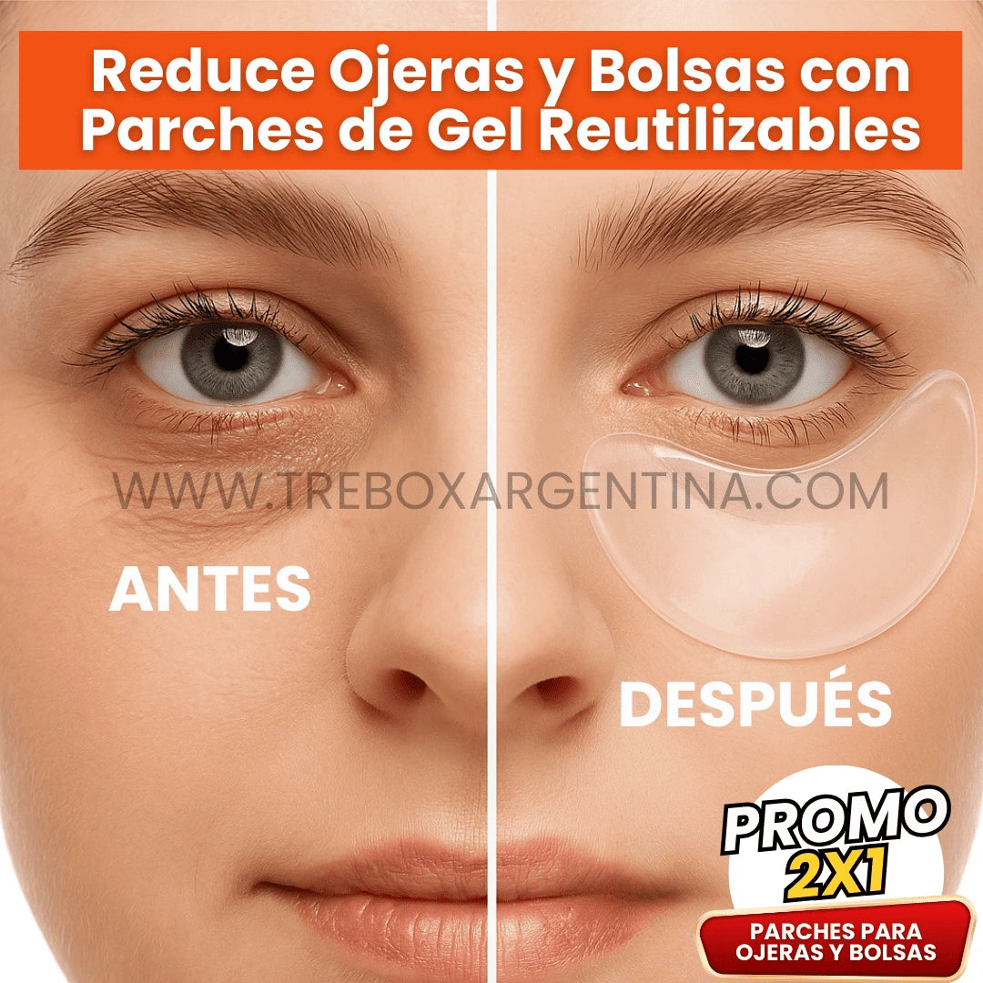 SkinLift | Parches de Gel para reducir Ojeras y Bolsas - 2x1 ¡Llevate 2 pares y Paga 1!