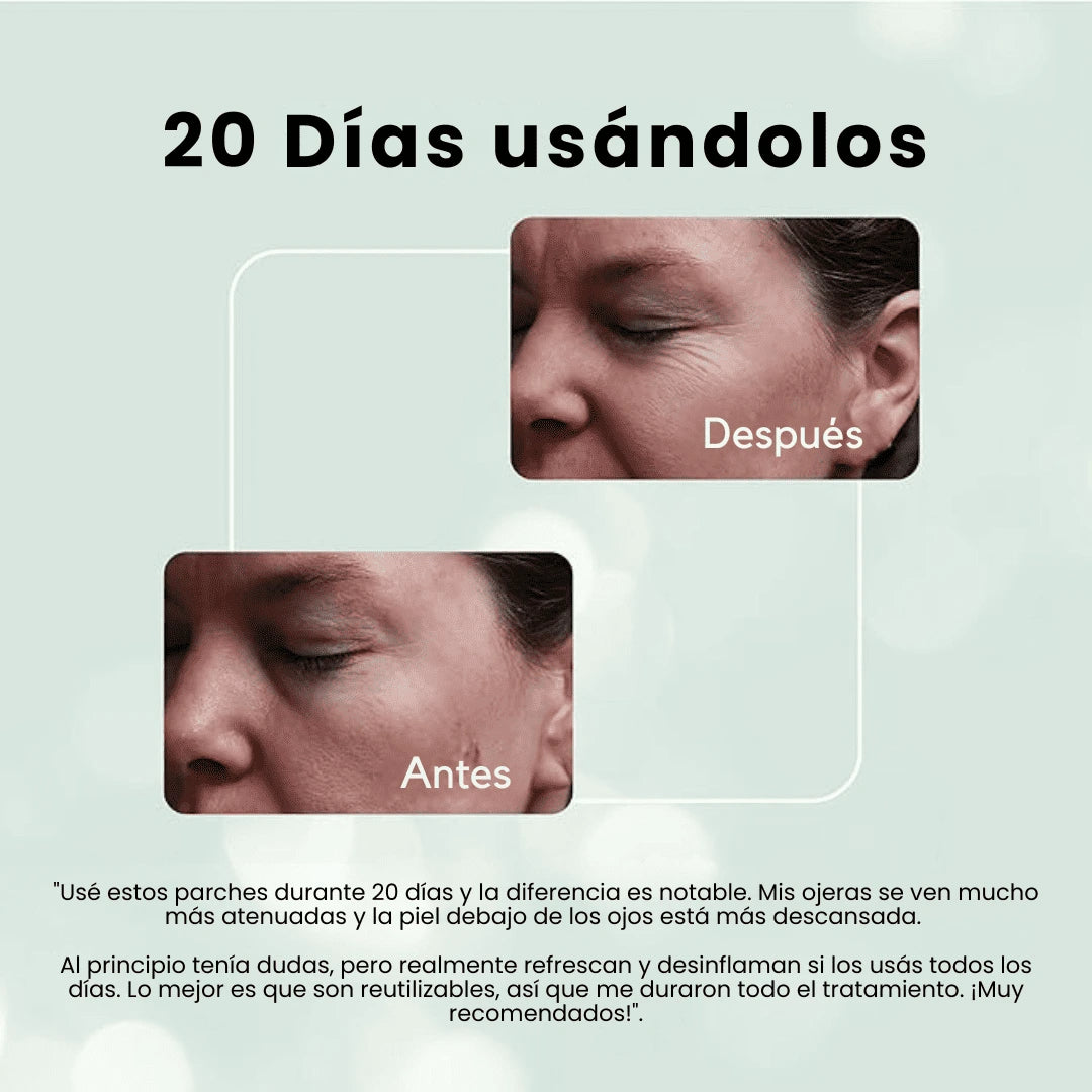 SkinLift | Parches de Gel para reducir Ojeras y Bolsas - 2x1 ¡Llevate 2 pares y Paga 1!
