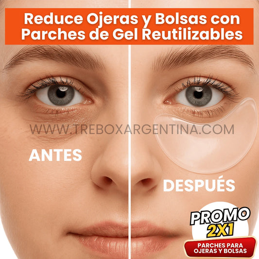 SkinLift | Parches de Gel para reducir Ojeras y Bolsas - 2x1 ¡Llevate 2 pares y Paga 1!