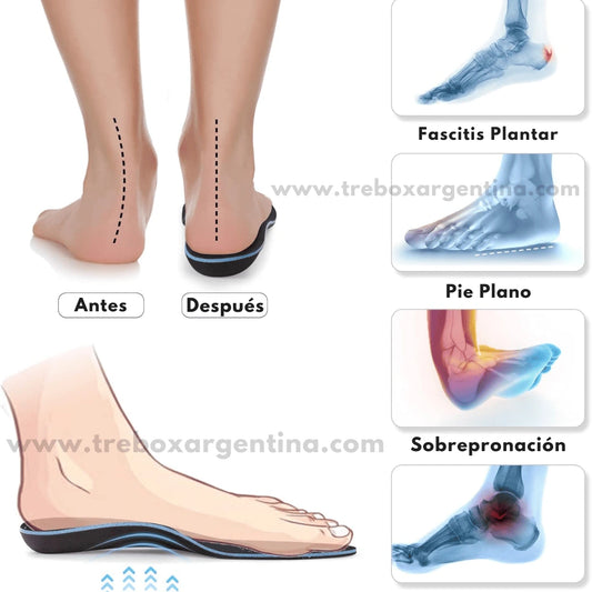 OrtoFlex | Alivio, confort y cuidado para tus pies